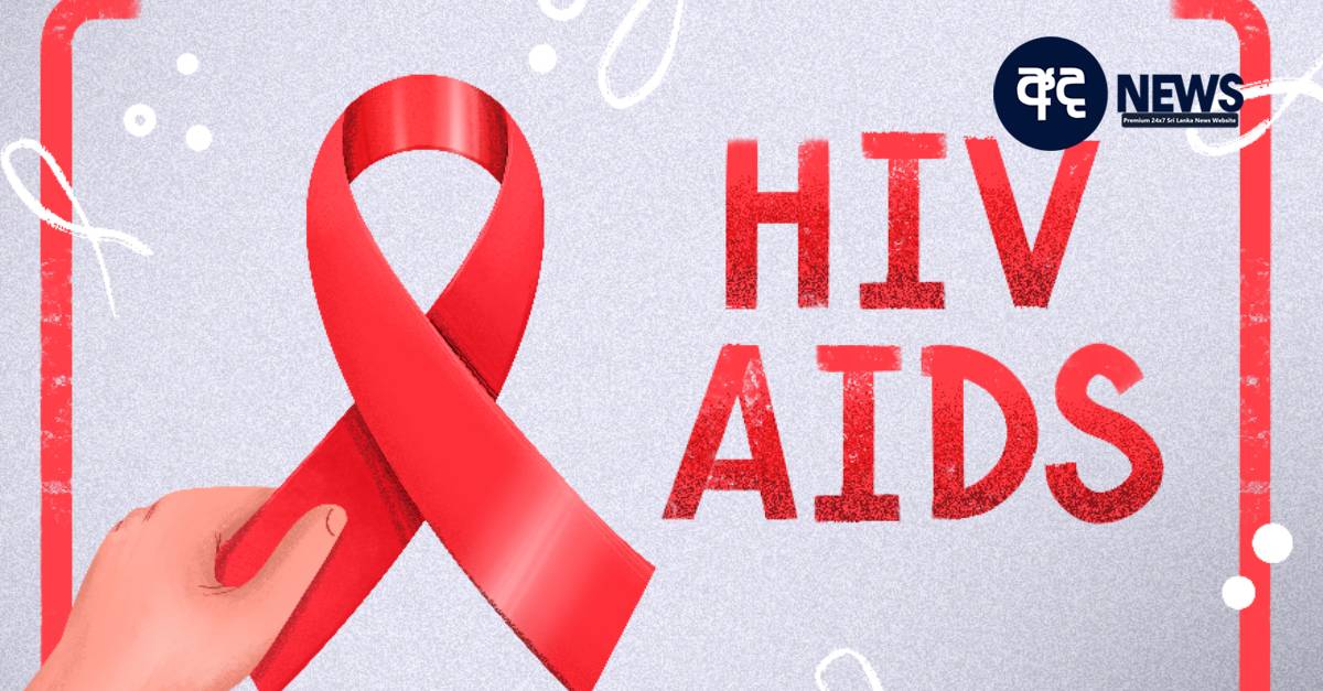 hiv aids